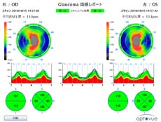 視神経乳頭周囲の神経線維の厚み
